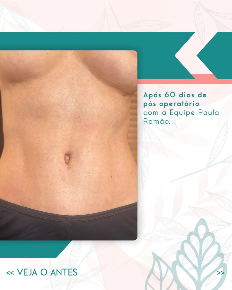 PRM—AntesXDepois_02