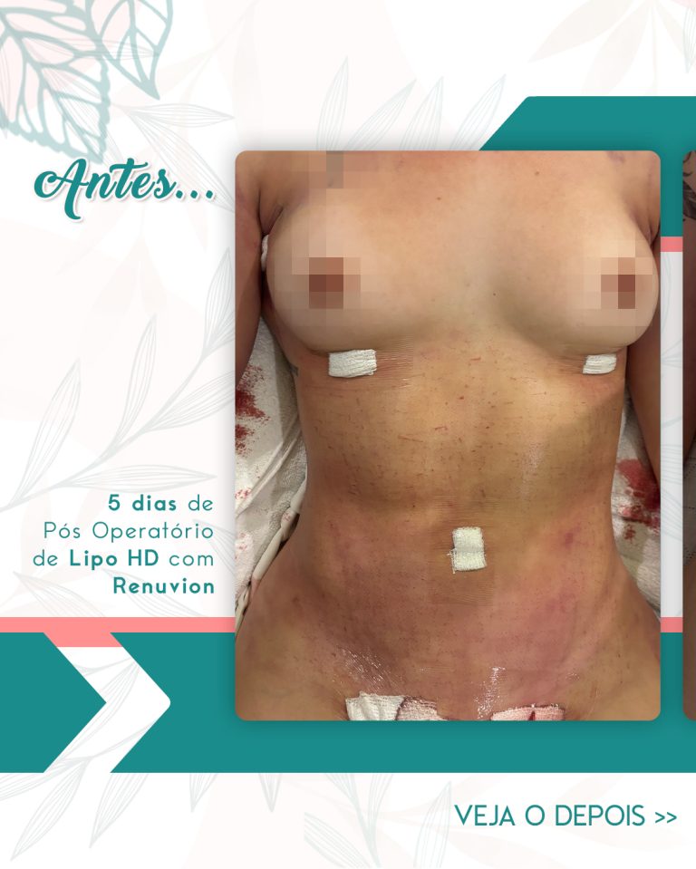 antantan_01